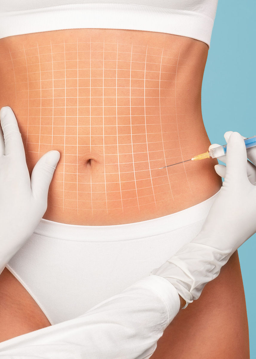 Mesotherapy Concept. Unrecognizable Doctor Taking Injection To Abdomen Of Young Woman, Beautician Wearing Gloves Making Aesthetic Procedure To Flat Female Belly With Drawn Mesh On It, Collage